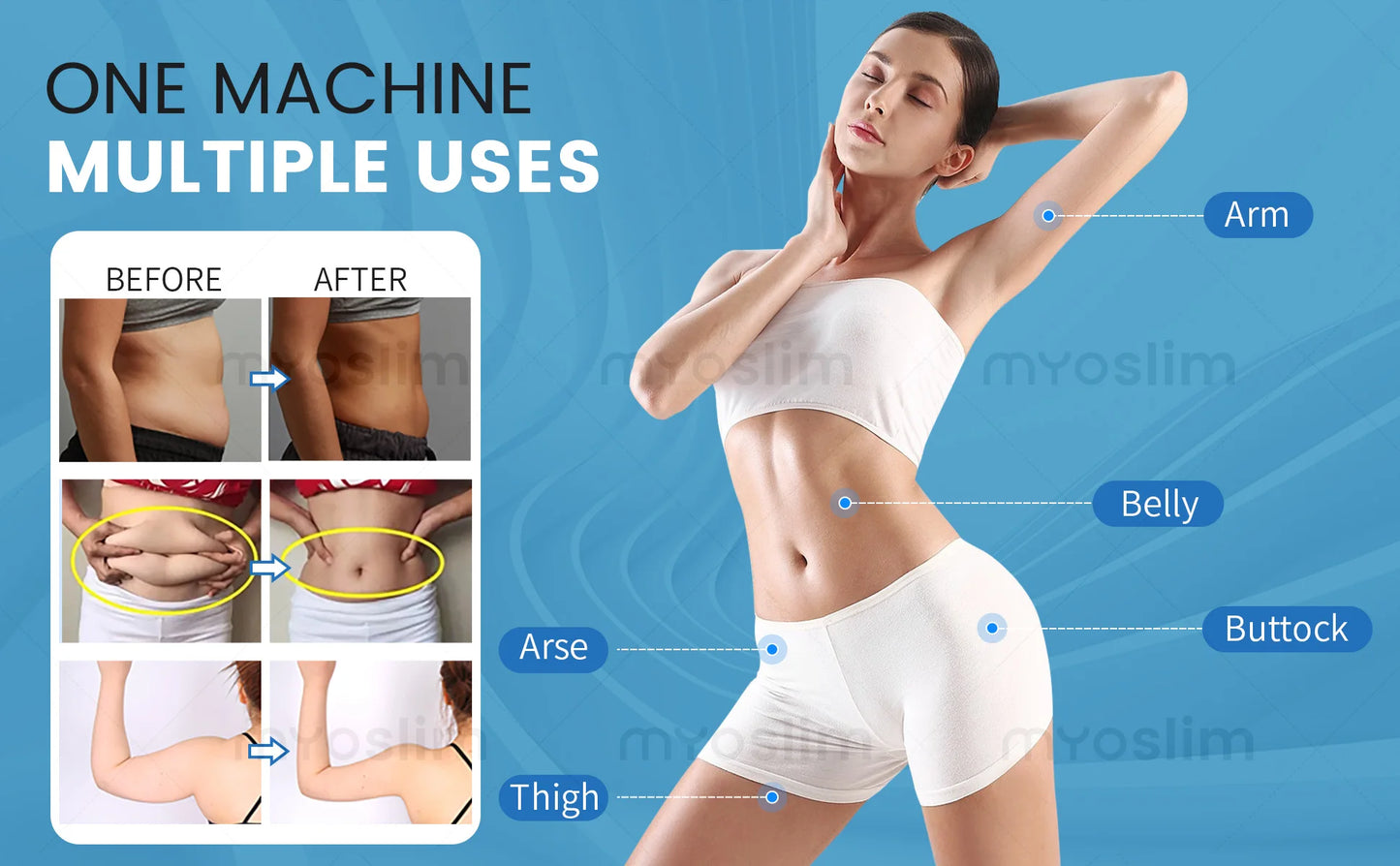 EMS Body Sculpting Machine 6500W MYIMuscle Building Fat Burning Abdominal Weight Loss Fitness Equipment