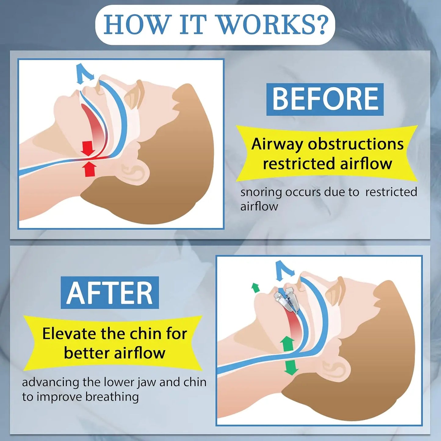 Anti-Snoring Mouth Guard, Adjustable Mouthpiece - Night Time Teeth Mouthguard & Sleeping Bite Guard for Bruxism and Stop Snoring