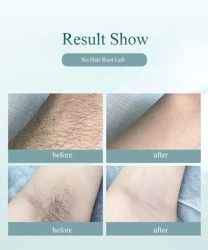 Vancostar Portable Laser Hair Removal Handset 900000 Flashes Painless Permanent Hair Remove for Women At-Home IPL Epilator