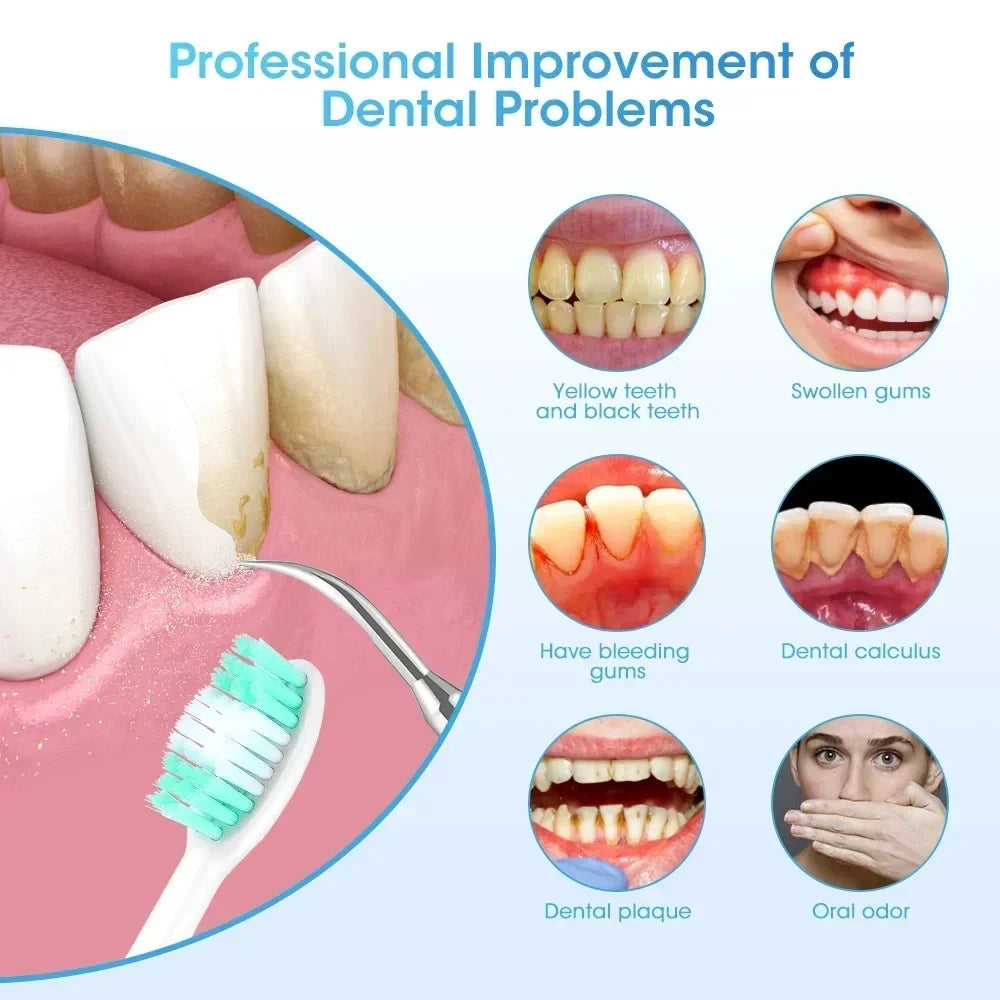 Ultrasonic Electric Sonic Dental Scaler Stain Tartar Calculus Remover Teeth Whitening Cleaning Oral Irrigator Electric