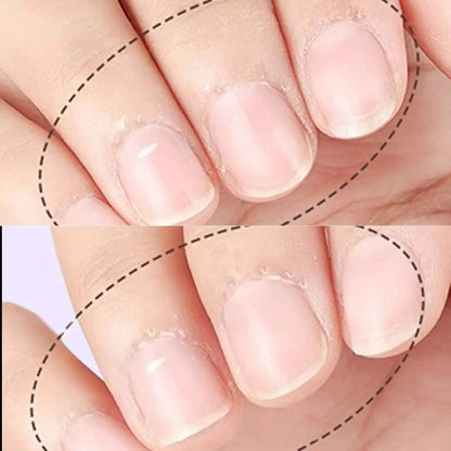 5PCS 3-in-1 Cuticle Oil Pen DeadSkin Remover Cuticle Pusher Grinding Pen With Ceramic Tip Cuticle Remover Pen Nail Care Tool
