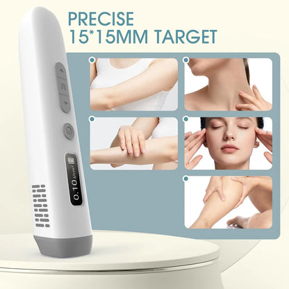 308nm UVB Vitiligo Phototherapy Lamp Handheld Home Use UV Light Therapy Device for Psoriasis Eczema White Spots Skin Treatment